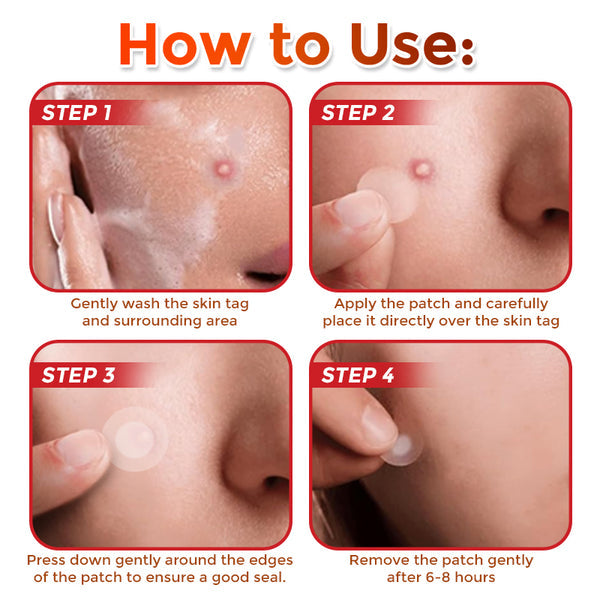 GFOUK Skin Tag Removal Patch