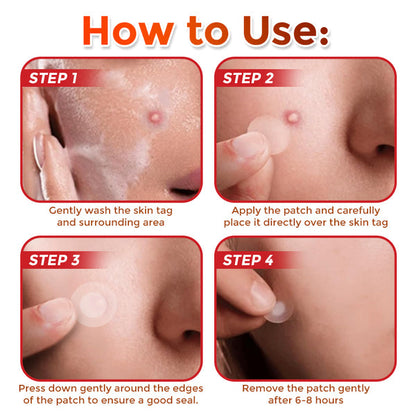 GFOUK Skin Tag Removal Patch