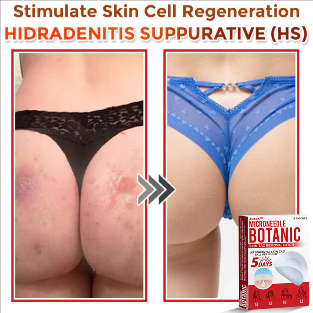 GFOUK Skin Tag Removal Patch